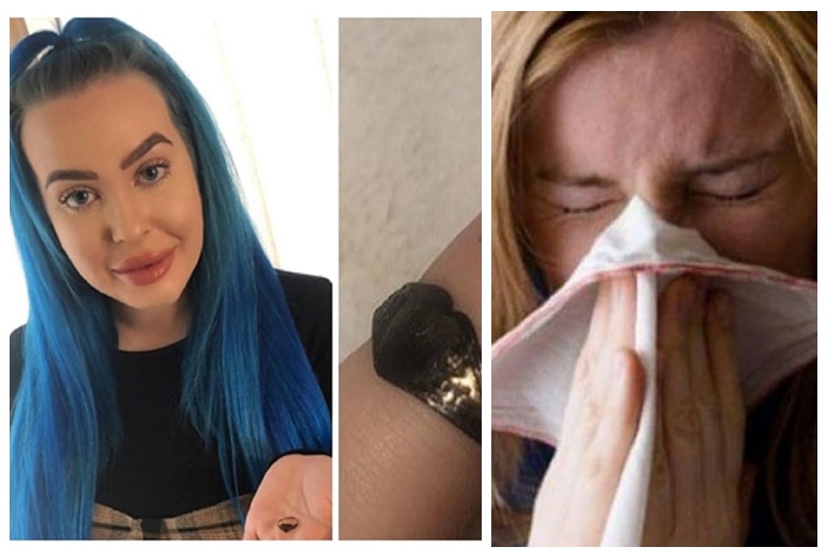 incident this woman sneezed out a ring that has been stuck in her nose for 12 years