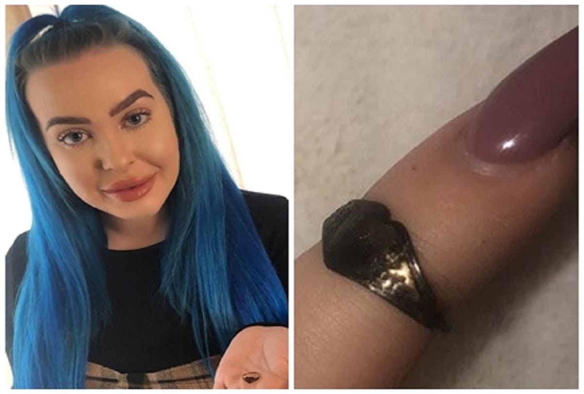 incident this woman sneezed out a ring that has been stuck in her nose for 12 years