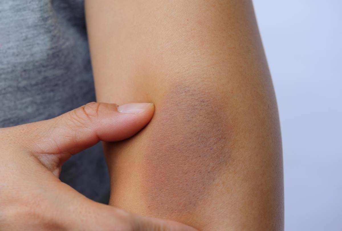 what does it mean if you have black spots on your body