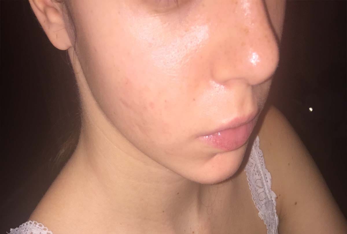what does it mean if you have black spots on your body