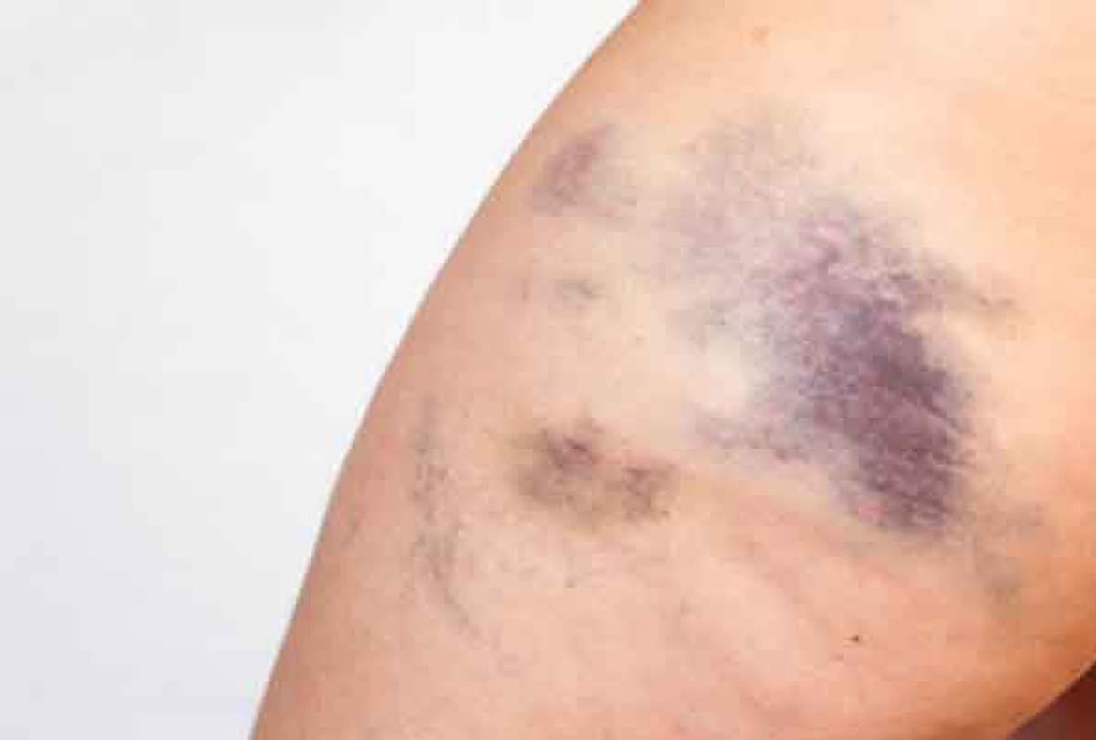 what does it mean if you have black spots on your body