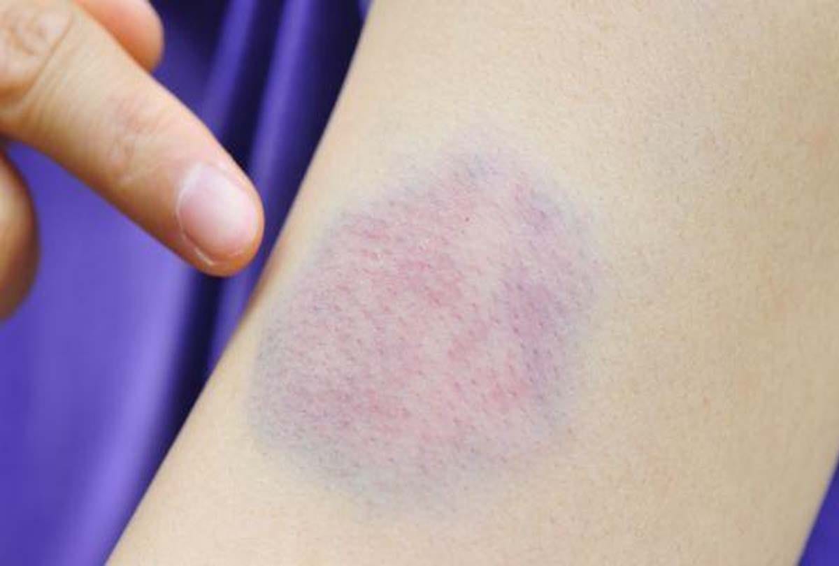 what does it mean if you have black spots on your body