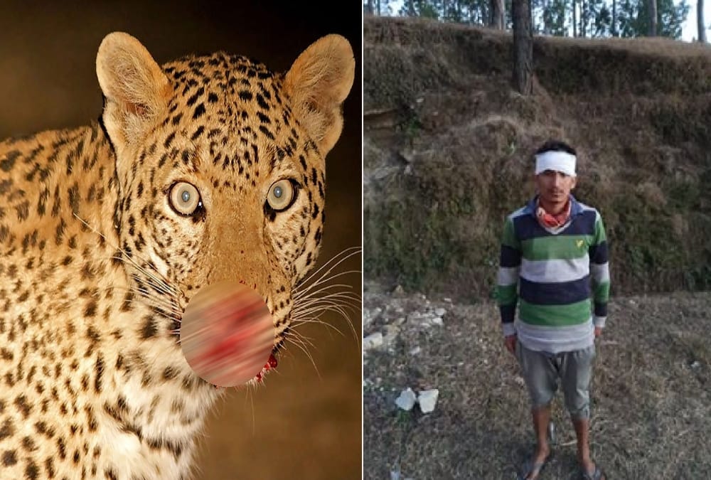 Boy fight with leopard during attack in bageshwar