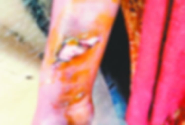 18 Year Old Daughter Tortured by Father in Chandigarh, Police Rescued the Girl