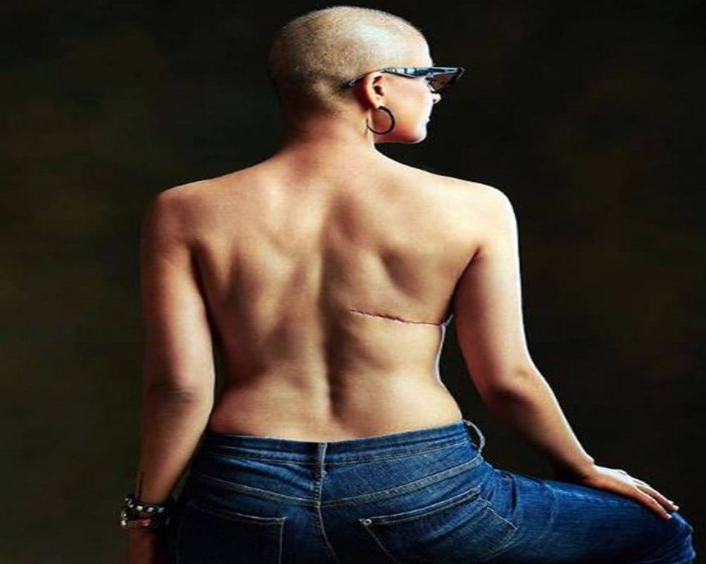 World Cancer Day 2019: Tahira Kashyap shares a bold pic with brave message on cancer day