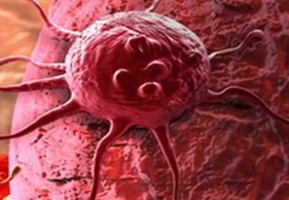 news related to cancer disease