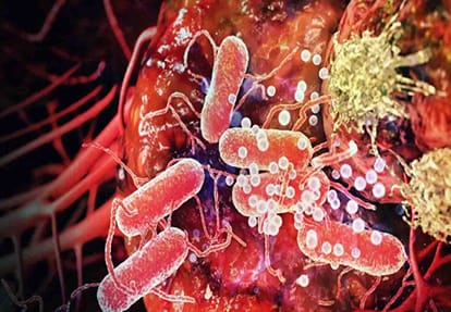news related to cancer disease