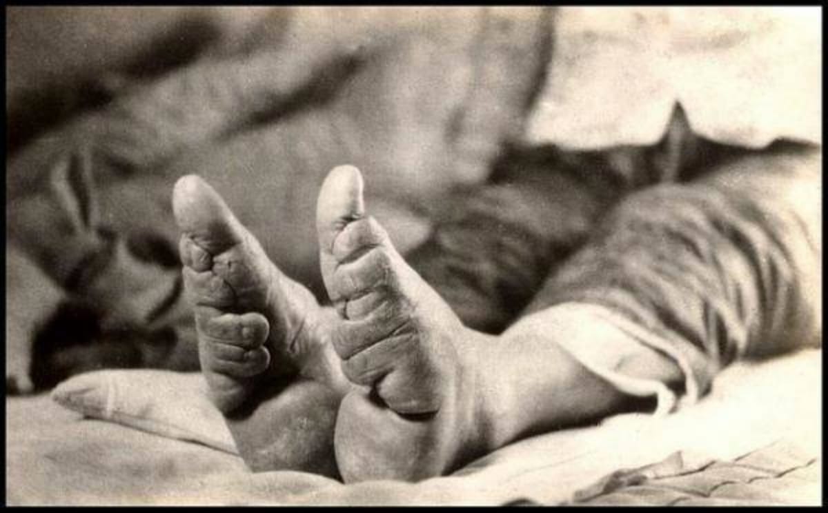 amazing foot binding bizarre practice for bound to be beautiful was symbol of beauty in china