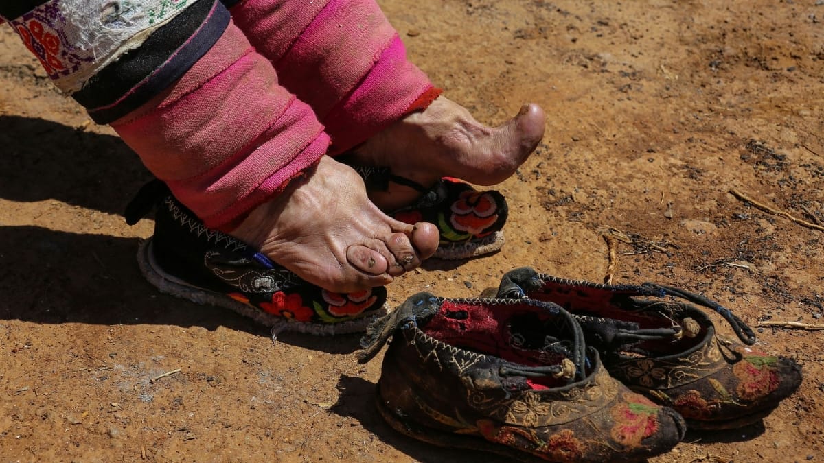 amazing foot binding bizarre practice for bound to be beautiful was symbol of beauty in china