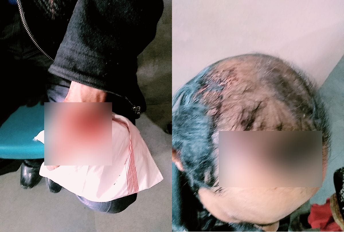 leopard attacked on a man in pahan shimla