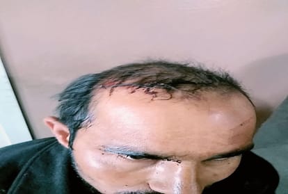 leopard attacked on a man in pahan shimla