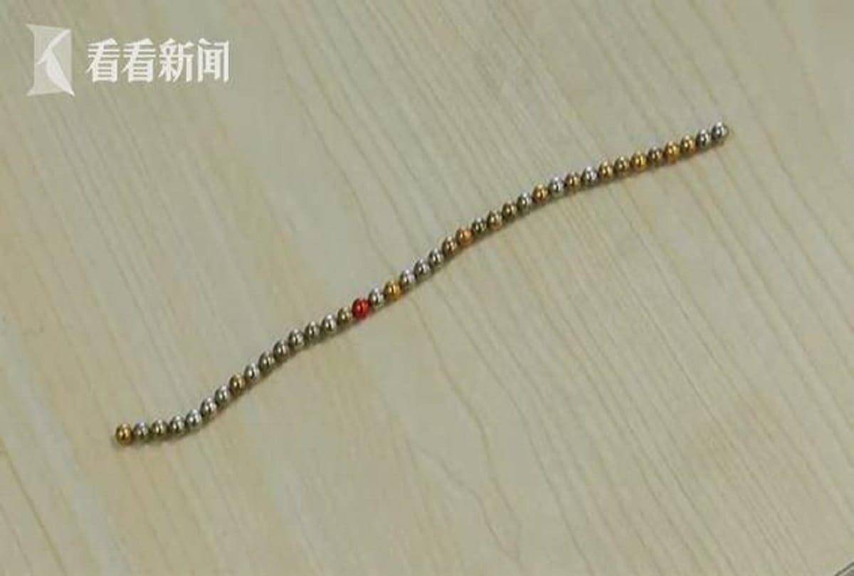 doctor removes 39 magnetic balls from teenager boys private part in china