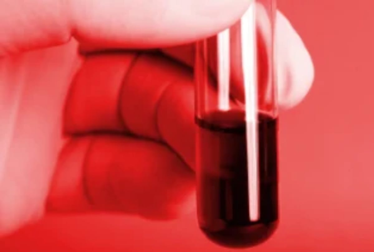 Invention of batteries by human blood and salt possible in future