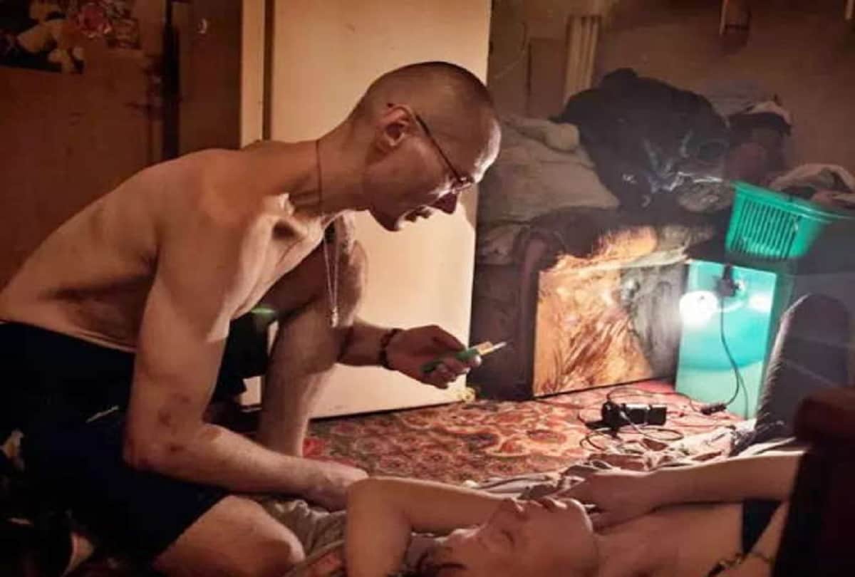 krokodil drug is the deadliest drug in the world which cause a woman rotten her body