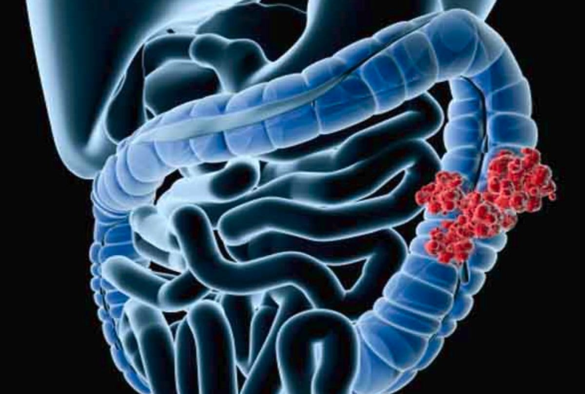 iit mandi: Now it will be easier to identify cancer in a test