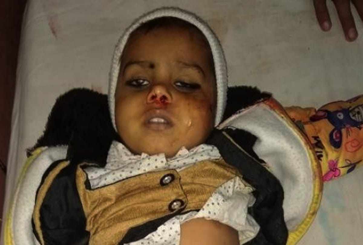five year old child died in harsh firing