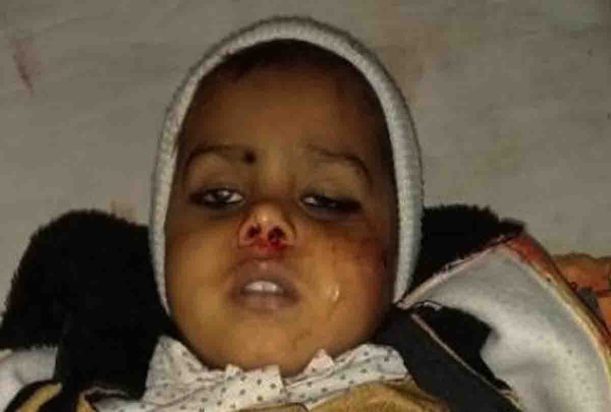 five year old child died in harsh firing