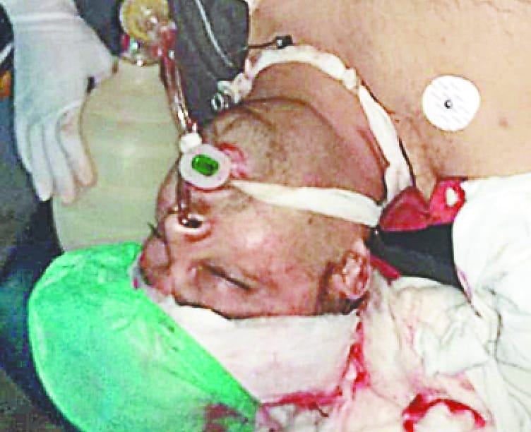 bride's brother shot dead in fireing