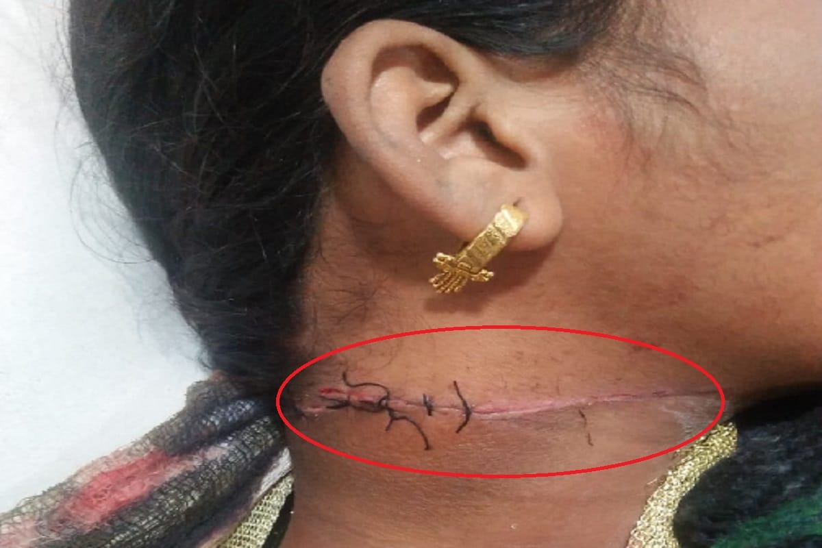 Meerut, misbehaved of girl and attacked and Police is investigating