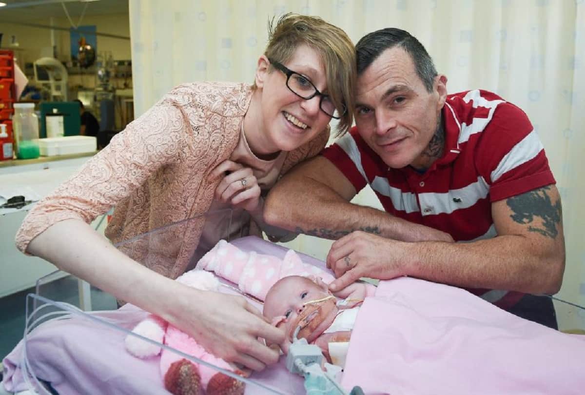 Strange story Miracle baby survives after born with heart outside her body