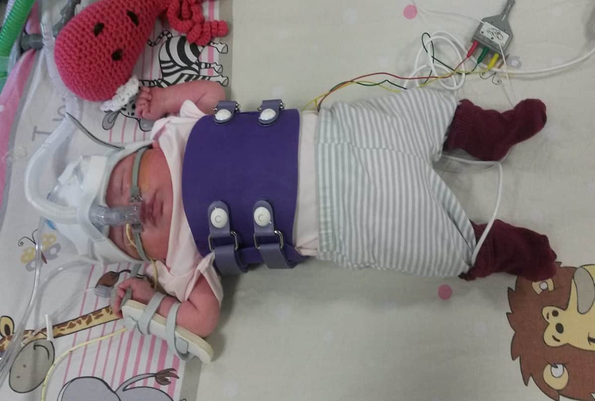 Strange story Miracle baby survives after born with heart outside her body