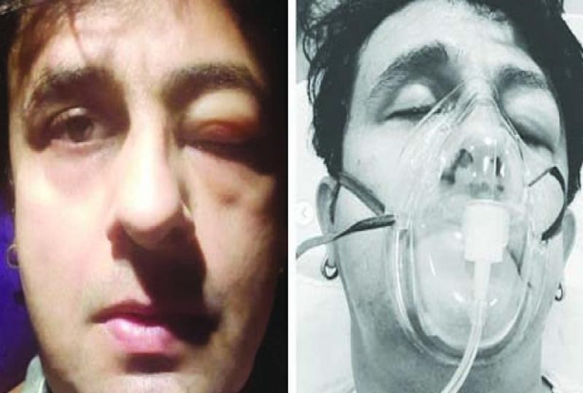 sonu nigam was admitted in hospital in nepal