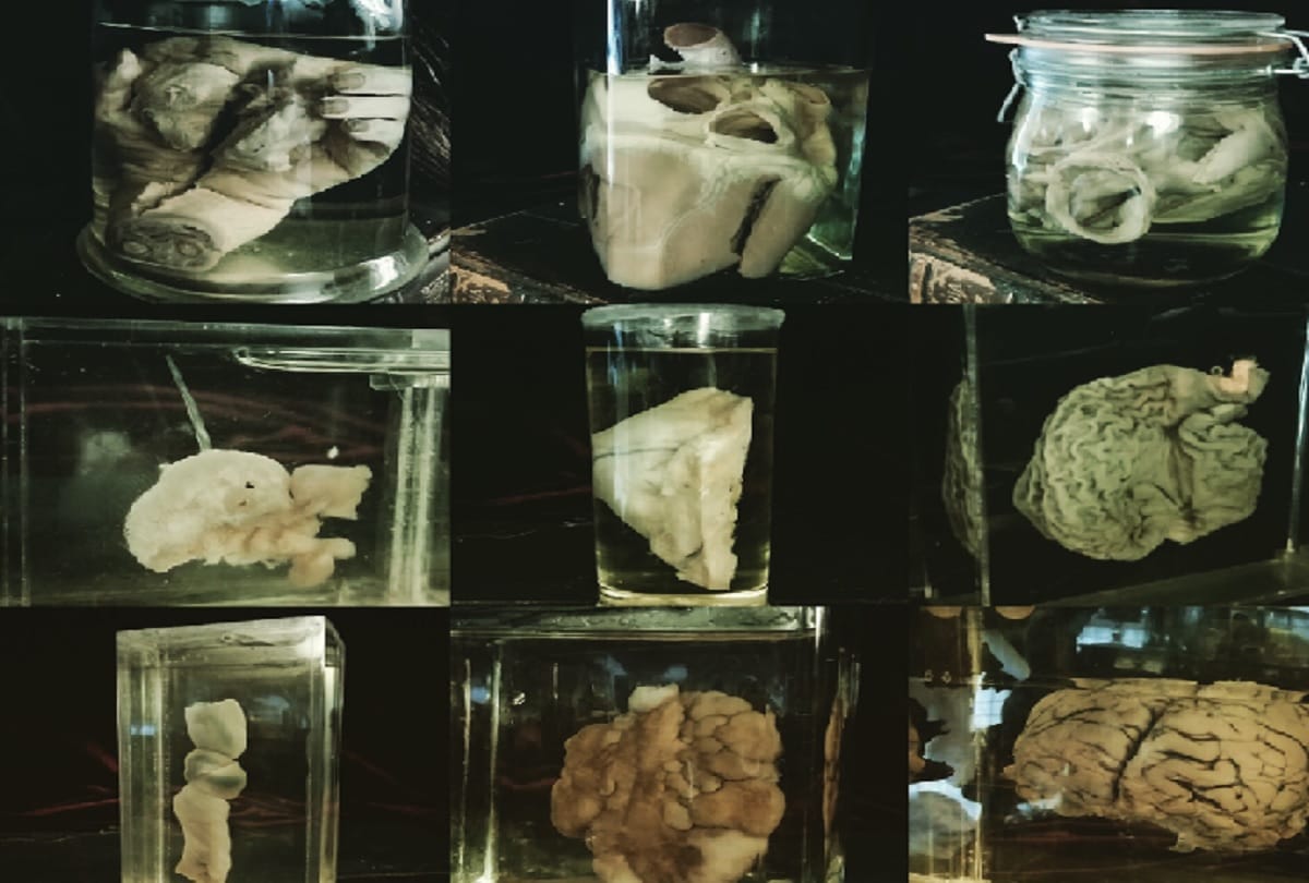 London Essex shop is selling pickled human body parts flesh and animal skulls