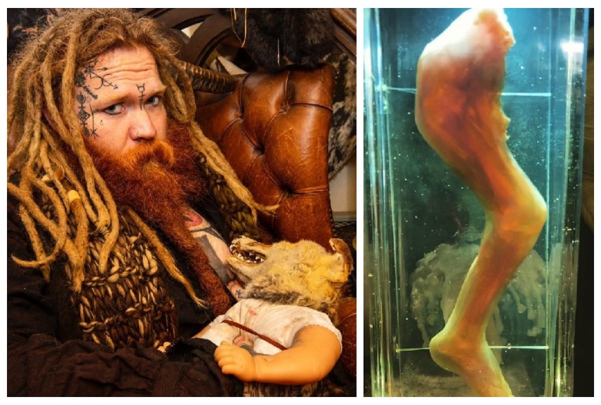 London Essex shop is selling pickled human body parts flesh and animal skulls