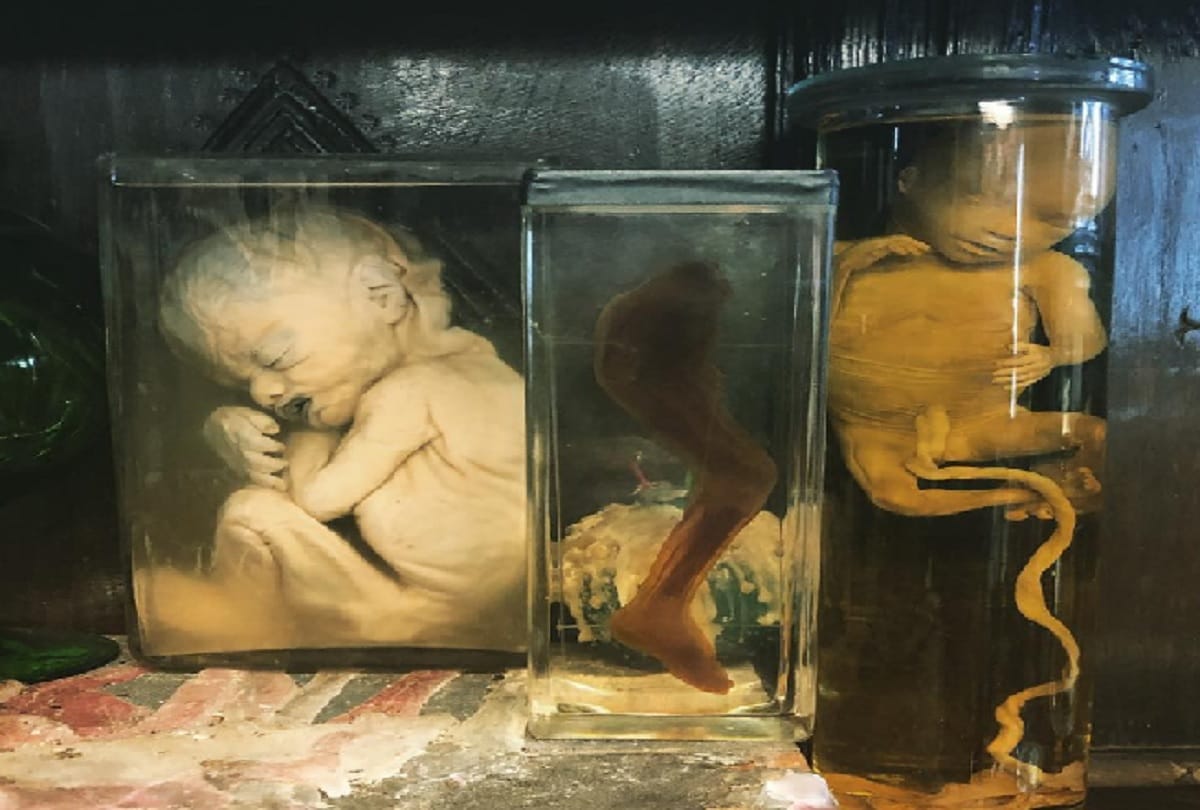 London Essex shop is selling pickled human body parts flesh and animal skulls