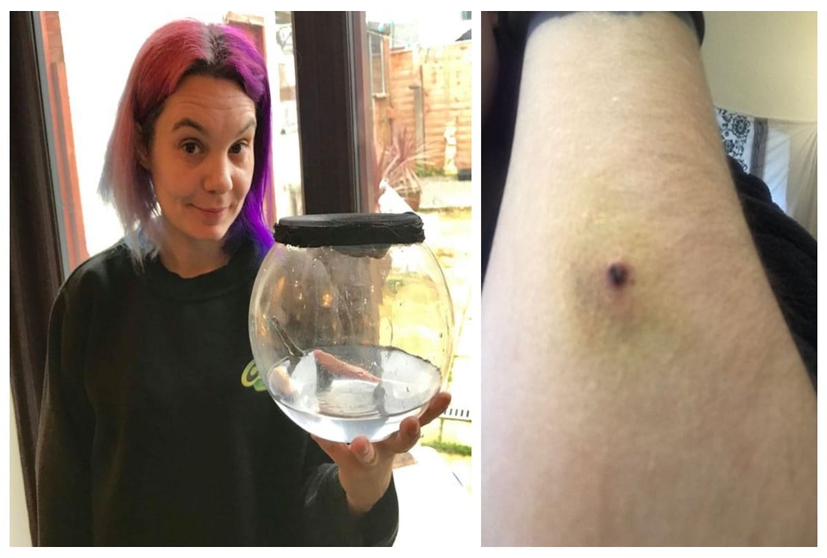 Leech lover woman who lets her bizarre pet drink her own blood