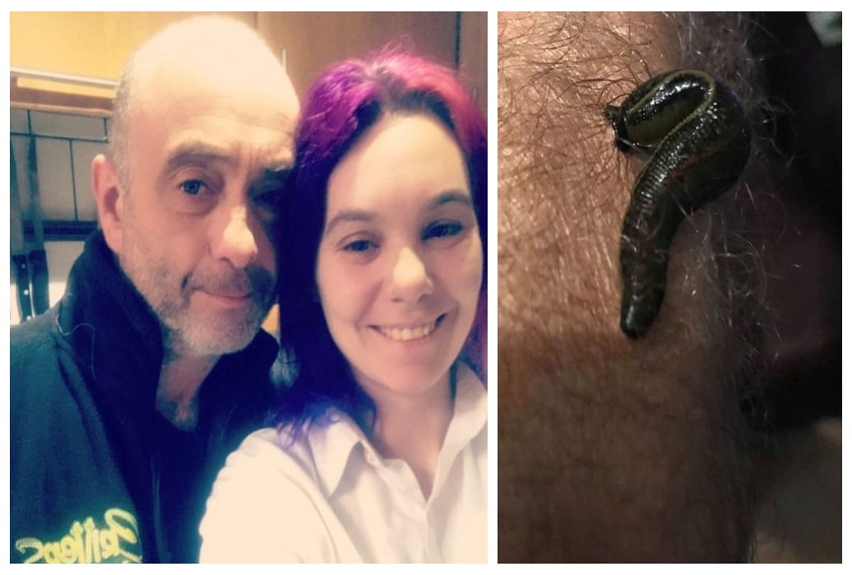 Leech lover woman who lets her bizarre pet drink her own blood