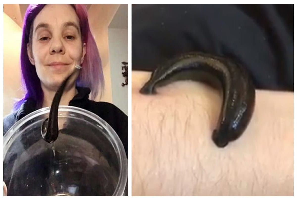 Leech lover woman who lets her bizarre pet drink her own blood