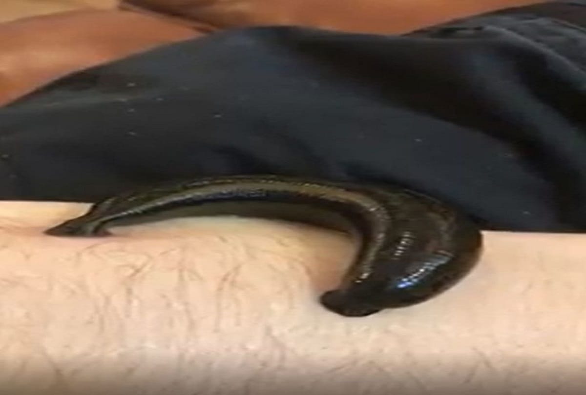 Leech lover woman who lets her bizarre pet drink her own blood