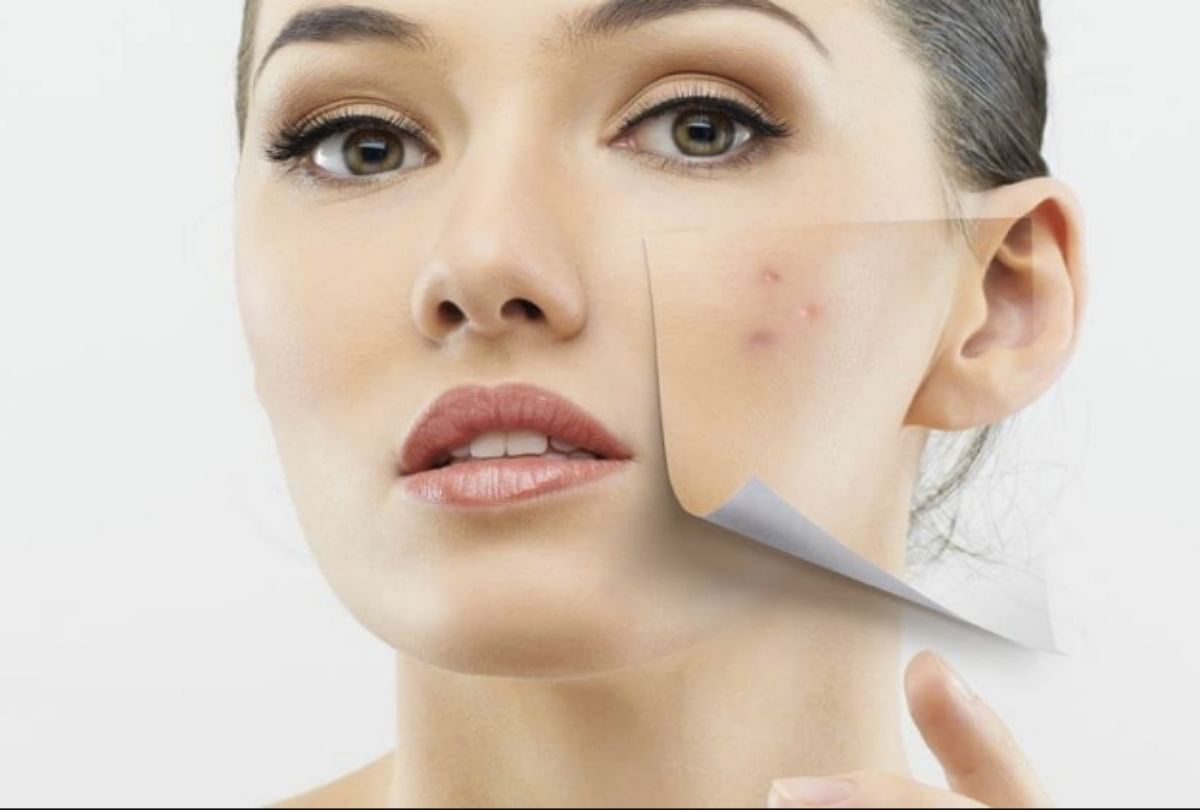 Skin Care How To Remove Spots From Face Naturally At Home In Hindi - Amar  Ujala Hindi News Live - Skin Care:प्राकृतिक तरीकों से मिटाने हैं चेहरे के  दाग-धब्बे तो अपनाएं ये