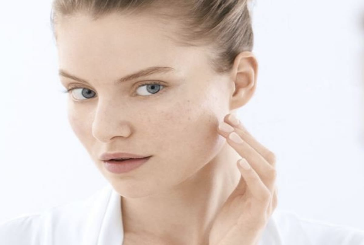 Beauty Tips keep these things in mind to reduce pimples