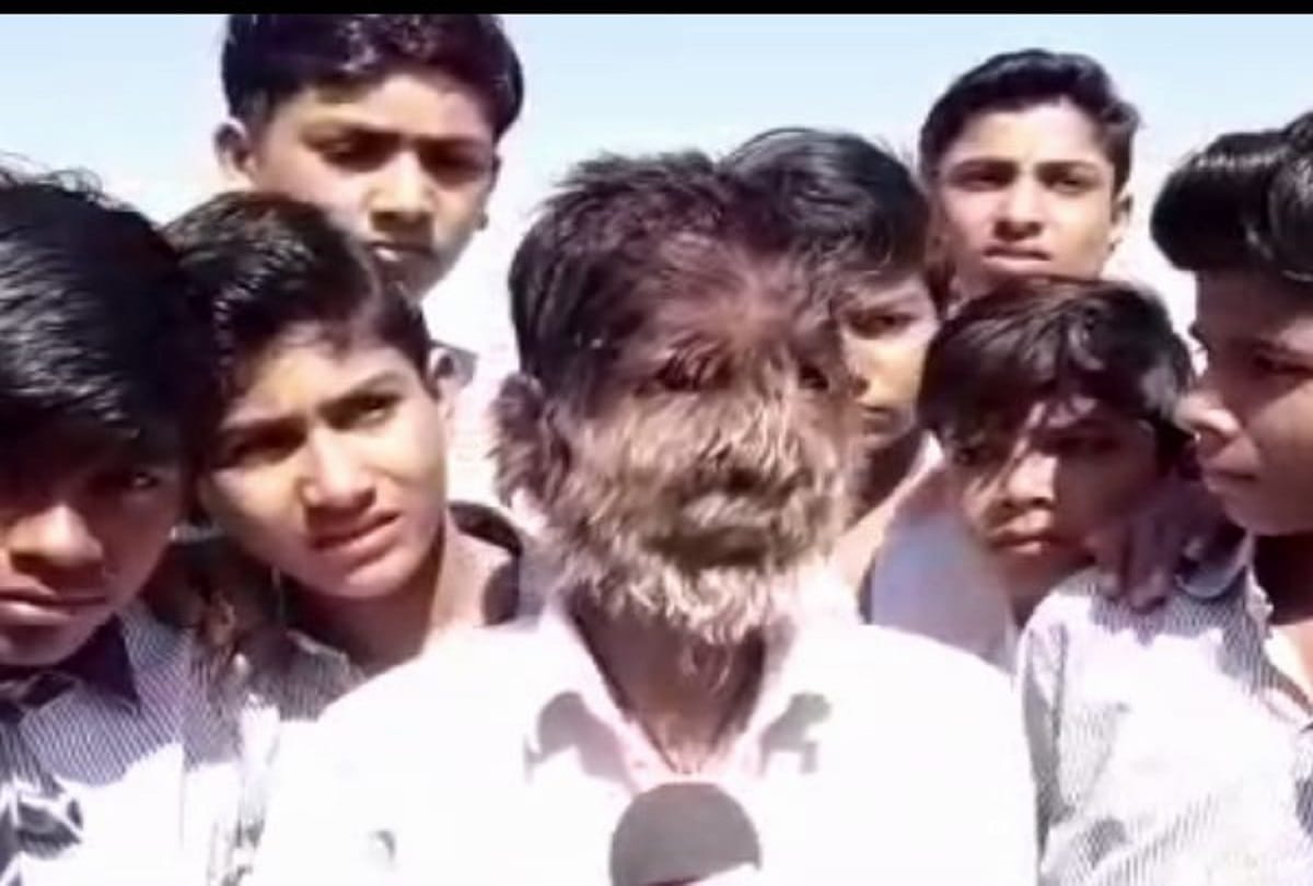hairs on entire face 13 year old lalit patidar from ratlam madhya pradesh