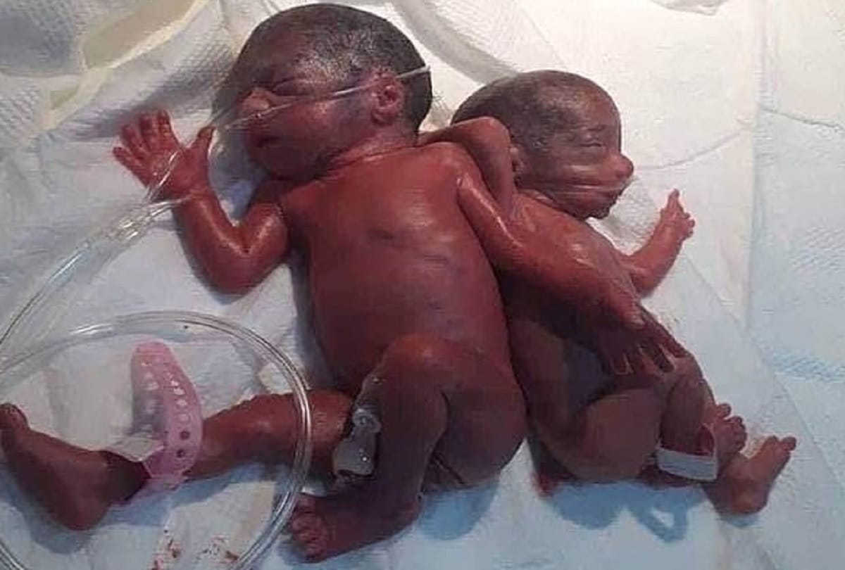 Iraqi mother gives birth NATURALLY to six girls and one boy countrys first SEPTUPLET pregnancy