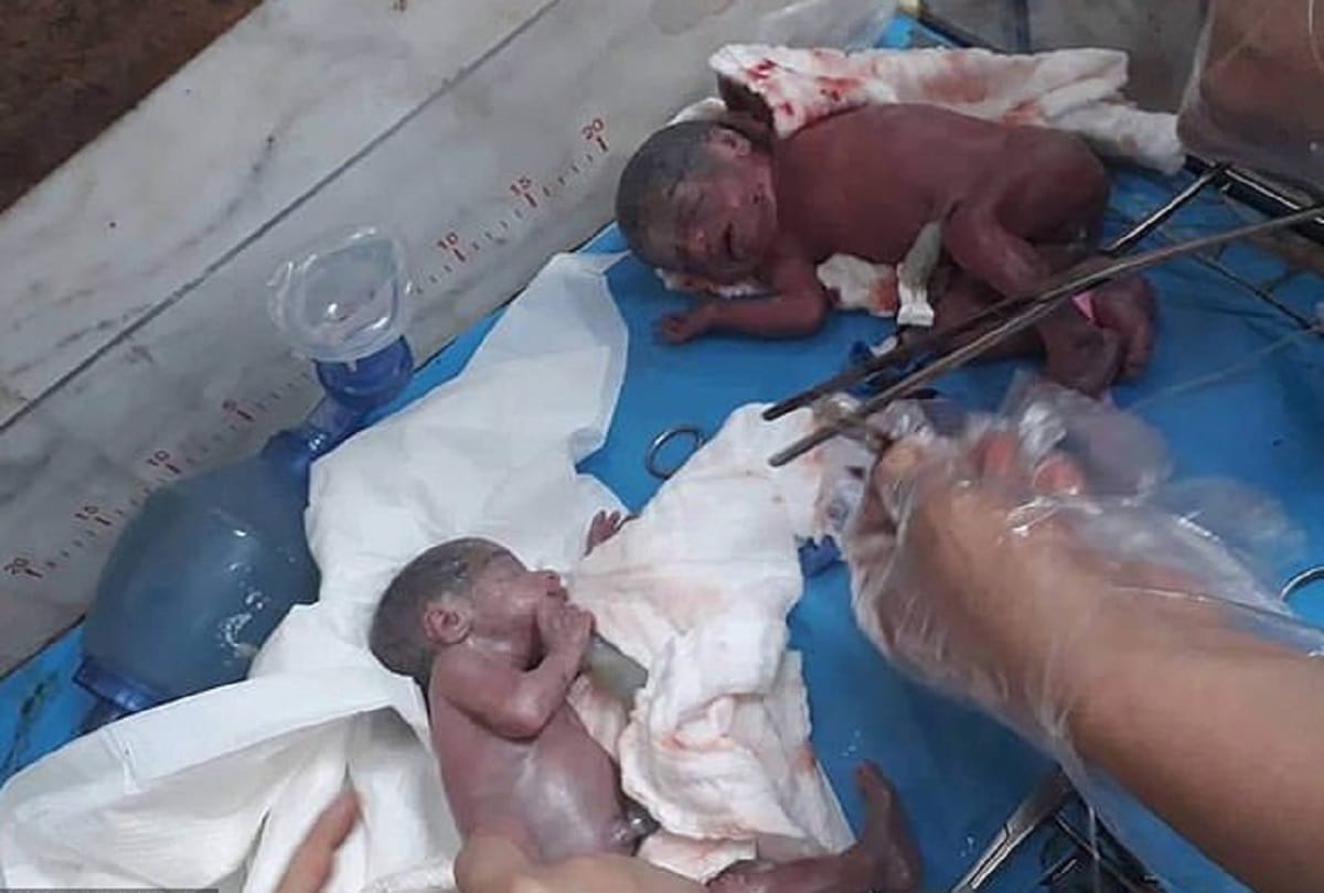 Iraqi mother gives birth NATURALLY to six girls and one boy countrys first SEPTUPLET pregnancy
