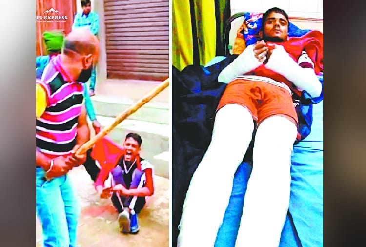 Chandigarh Nagar Nigam Councillor Husband Beats Boy Brutally, Fracture in Both Legs