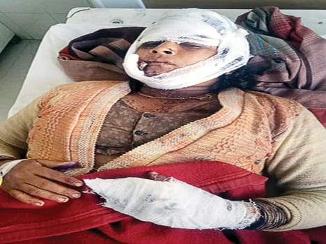 Youth killed the wife by killing her