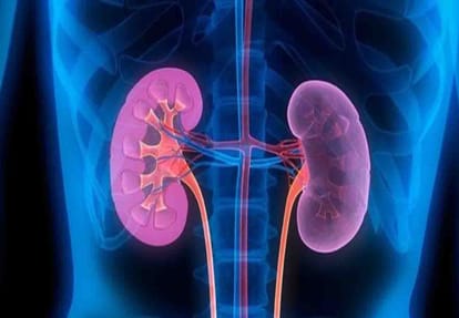 Kidney scandal case