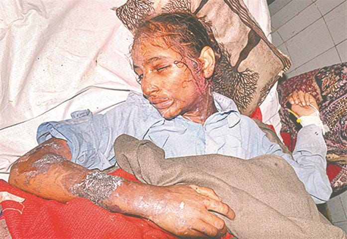 Acid attack: 'shadow' will remain in the shadow of Galshaana