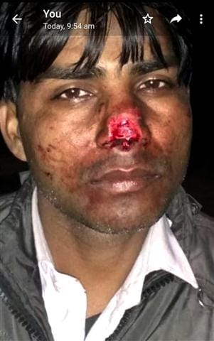 Jury opposes youth's nose