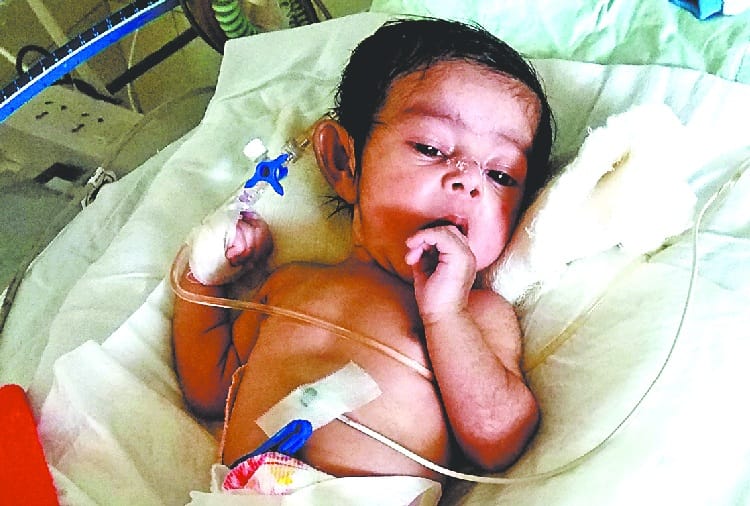 Food Pipe Missing from Baby Body, PGI Chandigarh Unique Surgery, Robotic Surgery