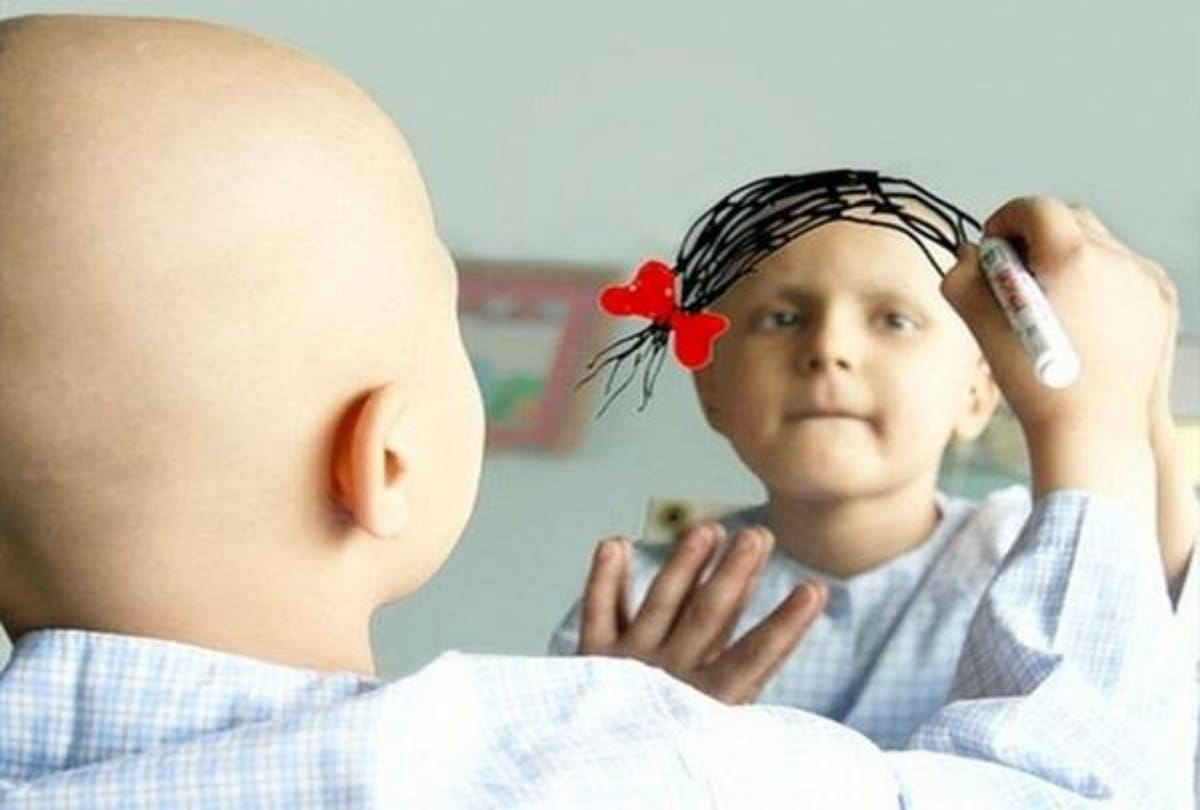 chemotherapy side effects and hair loss