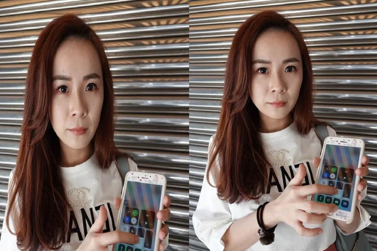 Never use smartphone with full brightness this woman has 500 holes in eye