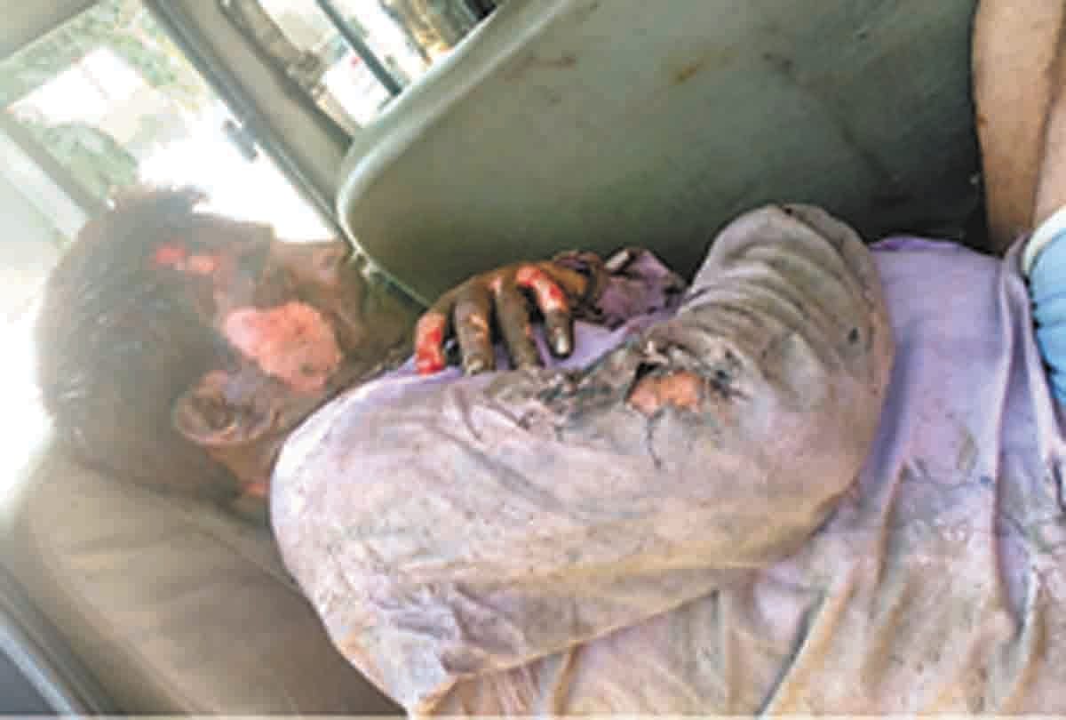 baaloo kaarobaariyon mein khoonee sangharsh, do jakhmee
