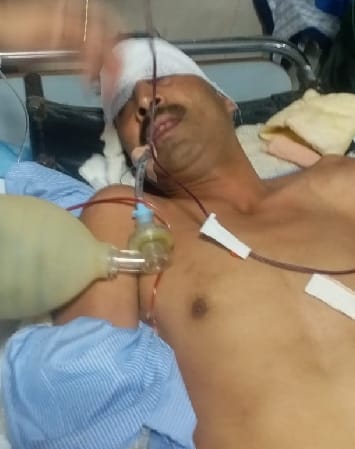 Fighter shot, serious in protest against robbery