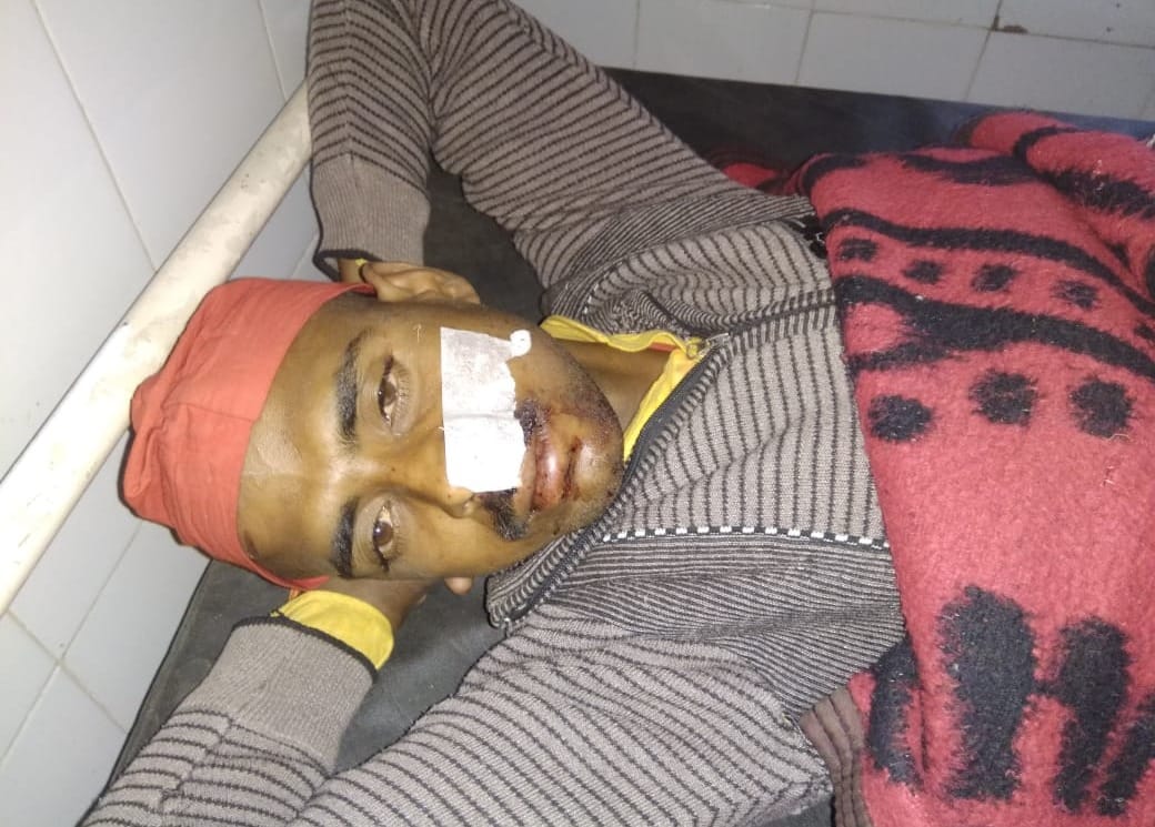 Kumbh 8 Reverent injured in accident in bhadohi