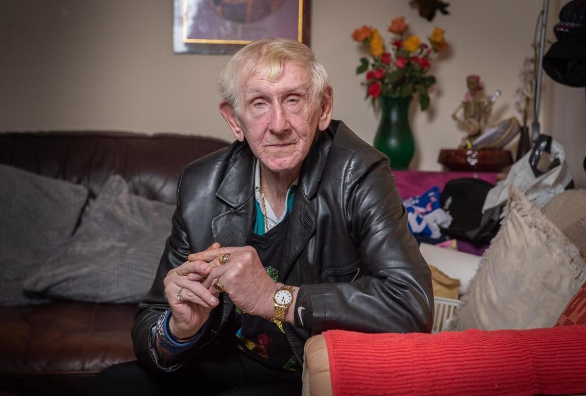 Cancer survivor melvyn mansell told shocking story of his hairy tongue